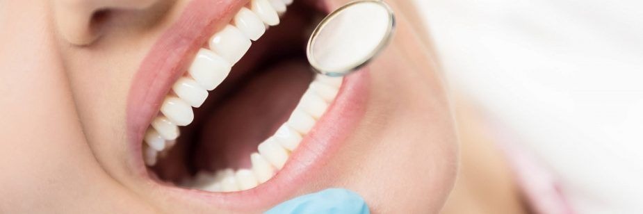 Qual a Diferença entre Implante Dentário e Prótese Dentária?